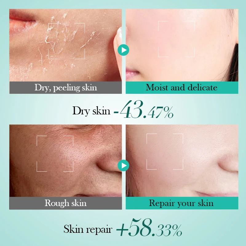 60g Bioaoua Hyaluronic Acid Moisturizing Repair Cream Care Whitenting Skin Products Soothing Firming Moisturizing Hydrating X4u5
60g Bioaoua Hyaluronic Acid Moisturizing Repair Cream Care Whitenting Skin Products Soothing Firming Moisturizing Hydrating X4u5