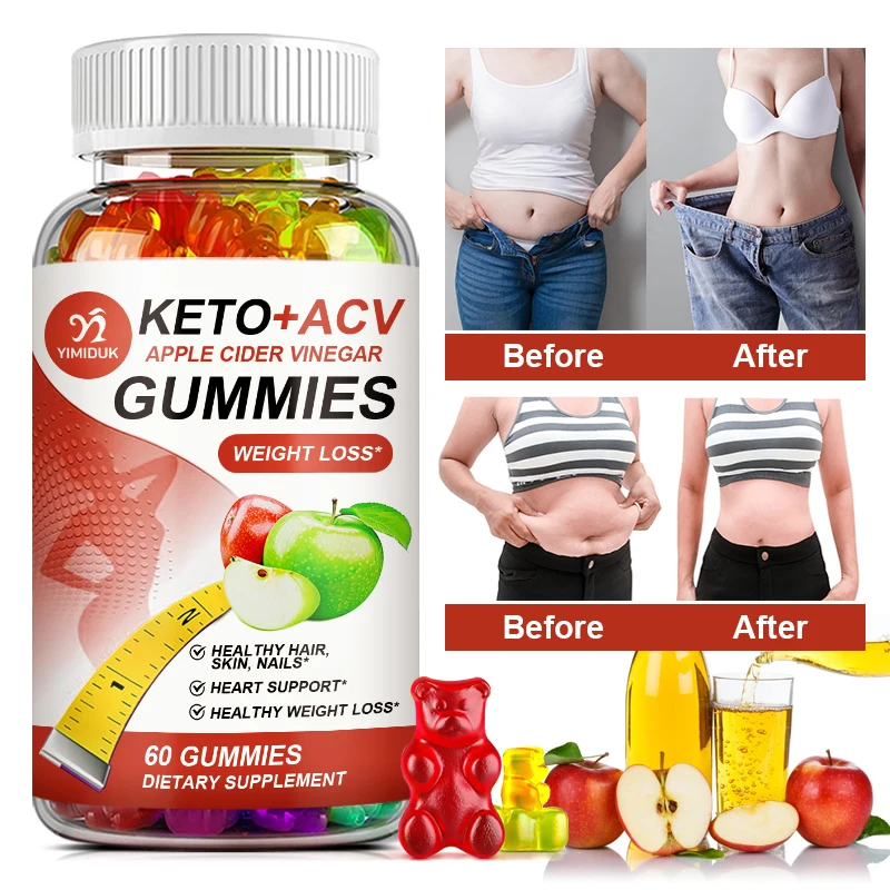 Keto Apple Cider Vinegar Gummies-Weight & Fat Management, Slimming,Burn Belly Fat, Detoxification, Digestion-Bear Gummy
Keto Apple Cider Vinegar Gummies-Weight & Fat Management, Slimming,Burn Belly Fat, Detoxification, Digestion-Bear Gummy