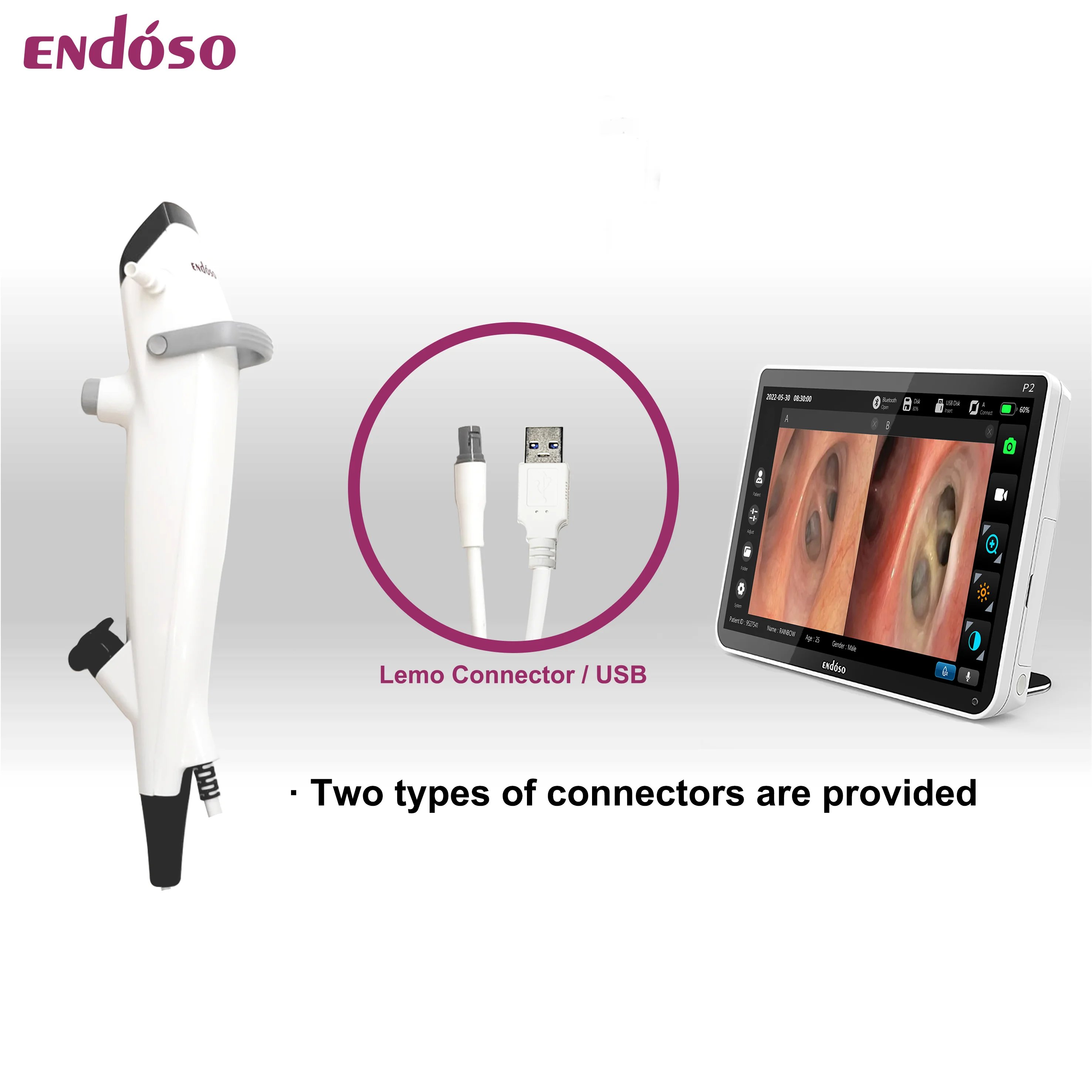 Endoso Flexible Disposable Bronchoscope 600MM Working Length Digital Single-Use Medical ENT
Endoso Flexible Disposable Bronchoscope 600MM Working Length Digital Single-Use Medical ENT