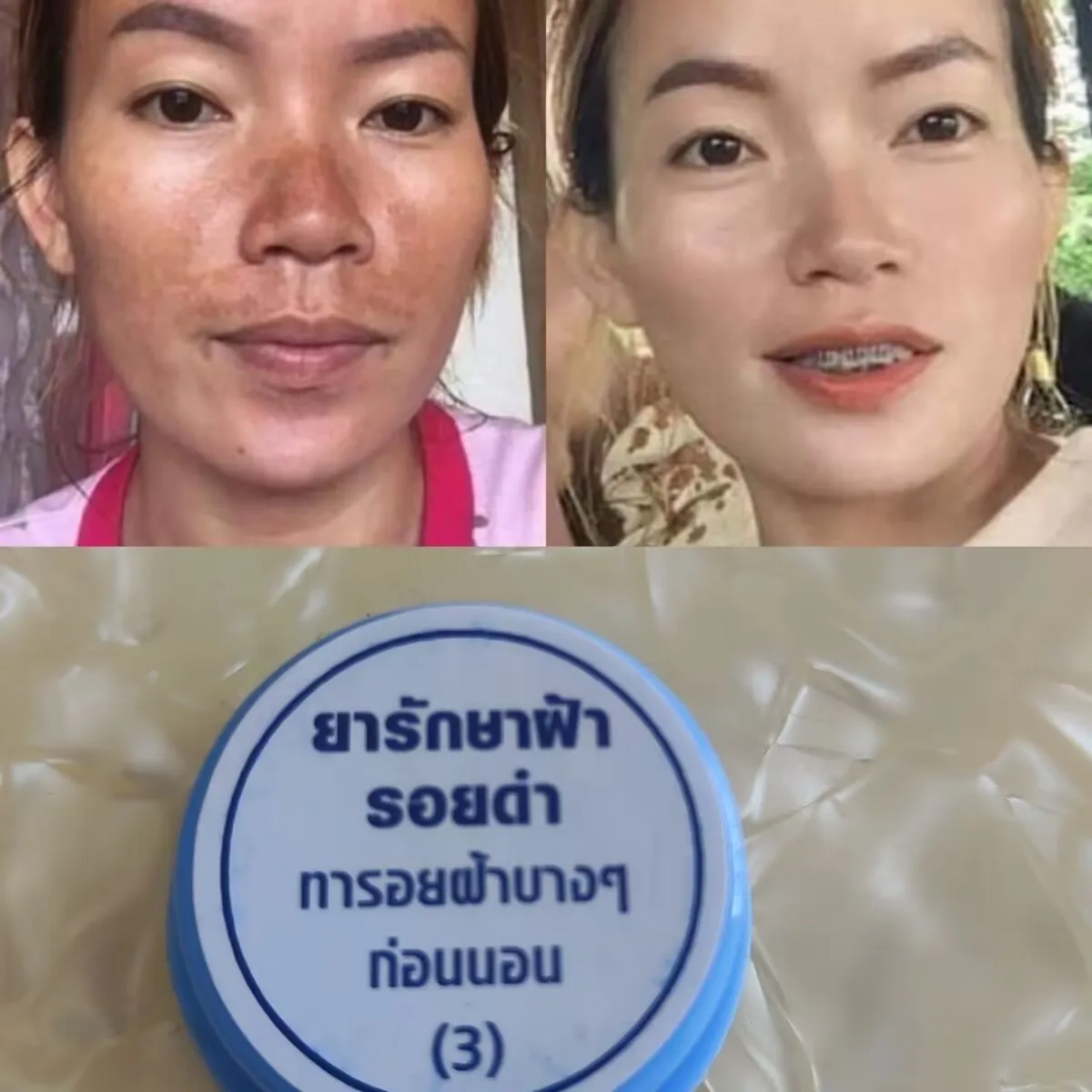 Thai Traditional Face Bright White Remove Freckles, Dark Spots, Blemishes, Acne, Moisturizing Brightening Soft And Smoother Skin
Thai Traditional Face Bright White Remove Freckles, Dark Spots, Blemishes, Acne, Moisturizing Brightening Soft And Smoother Skin