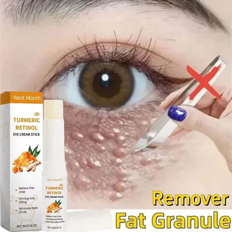 Eye Fat Granules Removal Eyestick Anti-Puffiness Firming Cream Anti Inflammatory Fade Fine Line Repair Skin Barrier Skin Care
Eye Fat Granules Removal Eyestick Anti-Puffiness Firming Cream Anti Inflammatory Fade Fine Line Repair Skin Barrier Skin Care