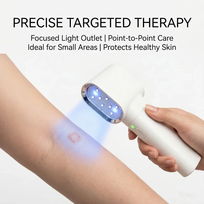 Narrow Band UVB 308NM Phototherapy Light Lamp for Skin Care Vitiligo Psoriasis Treatment Instrument Home Therapy Device
Narrow Band UVB 308NM Phototherapy Light Lamp for Skin Care Vitiligo Psoriasis Treatment Instrument Home Therapy Device
