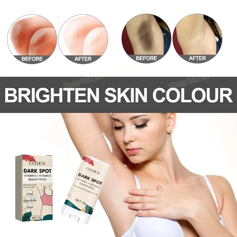 Fast-Acting Private Parts Whitening Essence for Buttocks Armpit Hip Knee Thigh Inner Melanin Removal Skin Brightening Serum
Fast-Acting Private Parts Whitening Essence for Buttocks Armpit Hip Knee Thigh Inner Melanin Removal Skin Brightening Serum