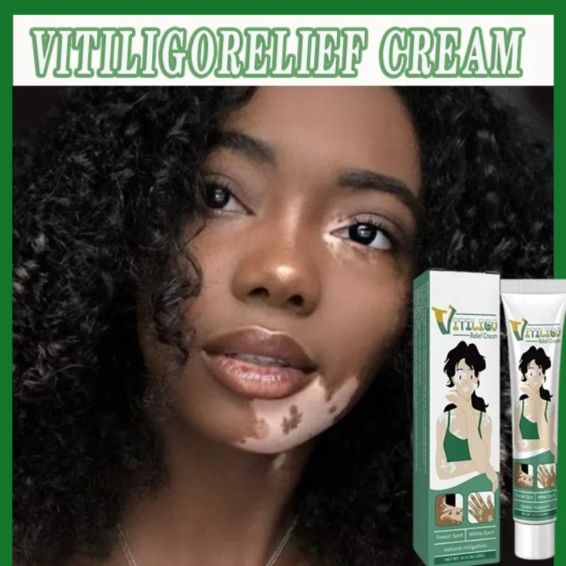 Vitiligo Removal White Spot Care Cream Skincare cream vitiligo skin Sweat spot Reduce white spots Skin care
Vitiligo Removal White Spot Care Cream Skincare cream vitiligo skin Sweat spot Reduce white spots Skin care