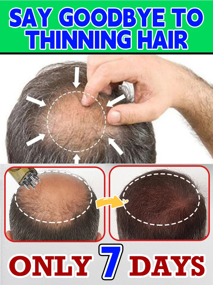 АПЛОКАДОР, MASAJE, ABORPCIN PROMOCIONAL, PARA CABELLO, VENTA CALIENTE, OFERTA PROMOCOCIONAL, HERRAMIENTA DE CUENTAS DE MASAJE, AD
АПЛОКАДОР, MASAJE, ABORPCIN PROMOCIONAL, PARA CABELLO, VENTA CALIENTE, OFERTA PROMOCOCIONAL, HERRAMIENTA DE CUENTAS DE MASAJE, AD