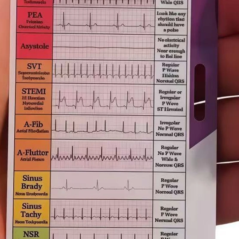 HX6A 3Pcs Professional 7 Step Ruler Card Portable Pocket Size Interpretation Guide Card For EKG Interpretation
HX6A 3Pcs Professional 7 Step Ruler Card Portable Pocket Size Interpretation Guide Card For EKG Interpretation
