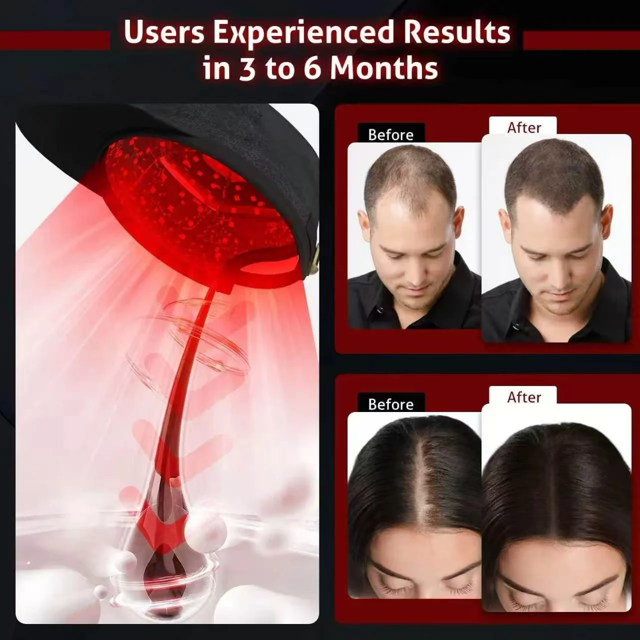 New 108Pcs Laser and Infrared LEDs Red Light Therapy Hair Growth Cap for Hair Regrowth Anti Hair Loss Relax Scalp Hair Care Hat
New 108Pcs Laser and Infrared LEDs Red Light Therapy Hair Growth Cap for Hair Regrowth Anti Hair Loss Relax Scalp Hair Care Hat