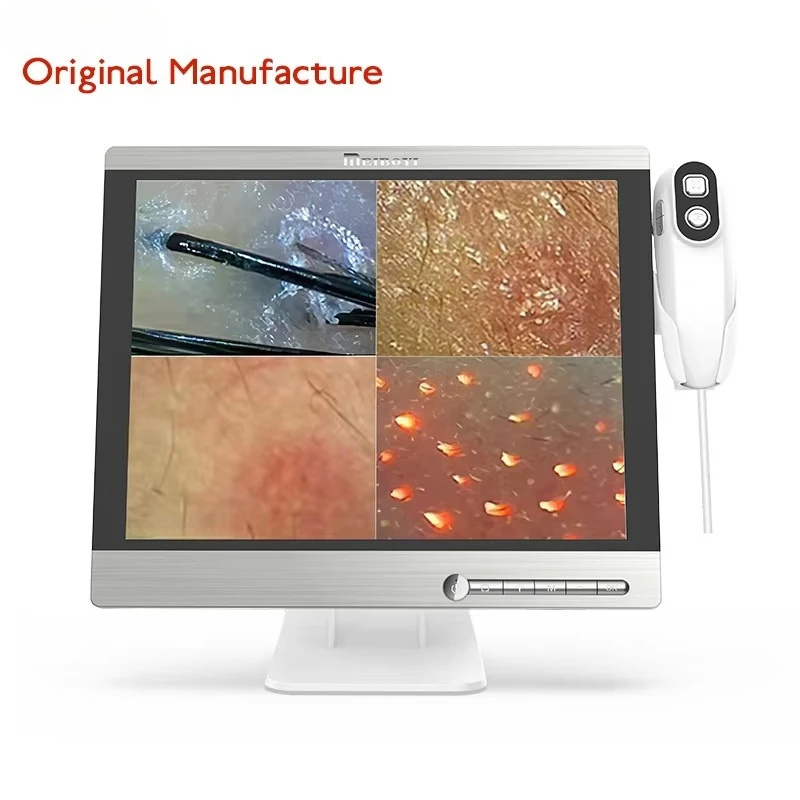 High Quality Handheld Multi-languages HD Scalp Analysis Machine Hair Analyzer for Analyze Scalp Problems
High Quality Handheld Multi-languages HD Scalp Analysis Machine Hair Analyzer for Analyze Scalp Problems