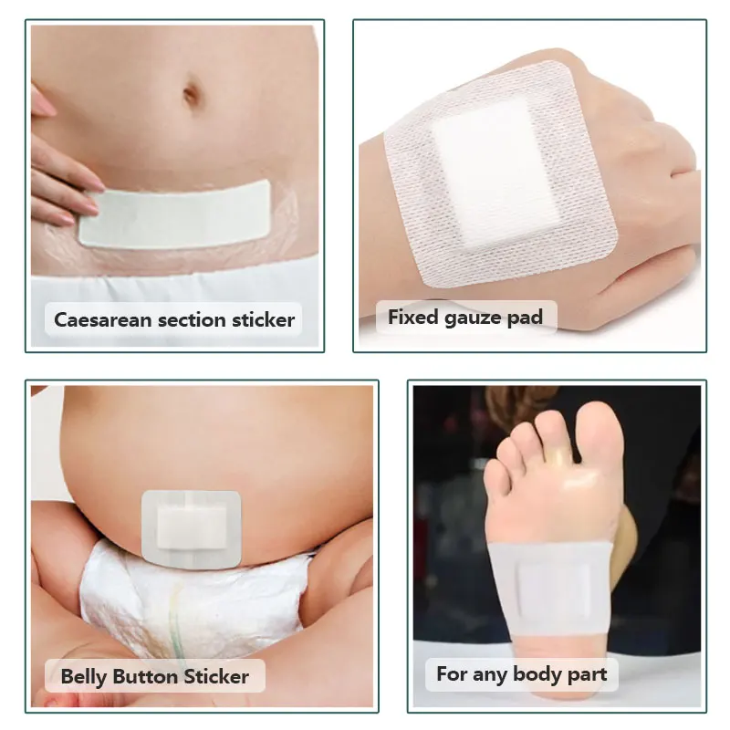 Mеdical Supplies Self-adhesive Wound Dressing Wound Care Products With CE/MDR/ISO13485 Certificated
Mеdical Supplies Self-adhesive Wound Dressing Wound Care Products With CE/MDR/ISO13485 Certificated