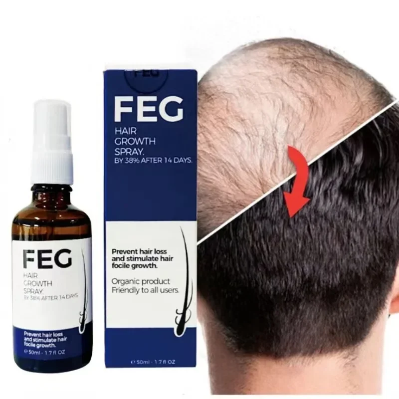 FEG hair growth spray original Organic Anti Loss Hair Growth Treatment Oil For Thicker Long Hair -50ML
FEG hair growth spray original Organic Anti Loss Hair Growth Treatment Oil For Thicker Long Hair -50ML