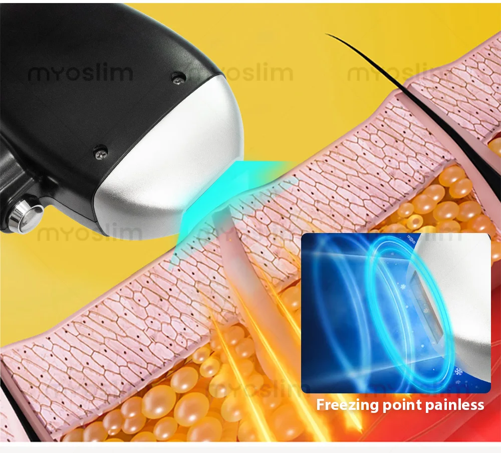 Myoslim 2 in 1 Picosecond Tattoo And Hair Removal Painless With 3 Adjustable Wavelengths 755 808 1064nm for Salon Or Home
Myoslim 2 in 1 Picosecond Tattoo And Hair Removal Painless With 3 Adjustable Wavelengths 755 808 1064nm for Salon Or Home