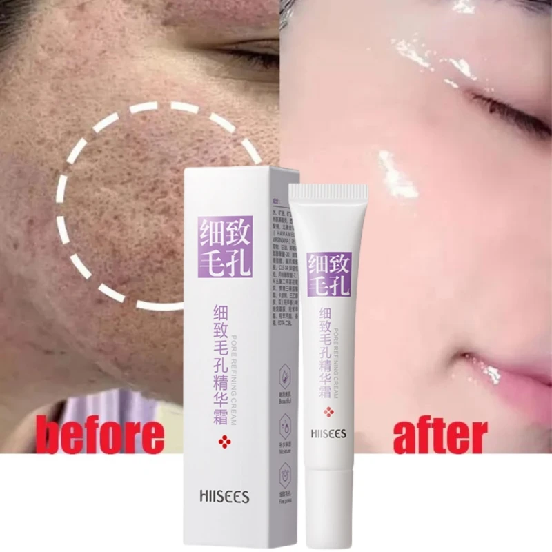 Salicylic Acid Pore Shrink Face Cream Quick Elimination Large Pore Brighten Tighten Minimize Skin Pore Remove Blackehead Product
Salicylic Acid Pore Shrink Face Cream Quick Elimination Large Pore Brighten Tighten Minimize Skin Pore Remove Blackehead Product