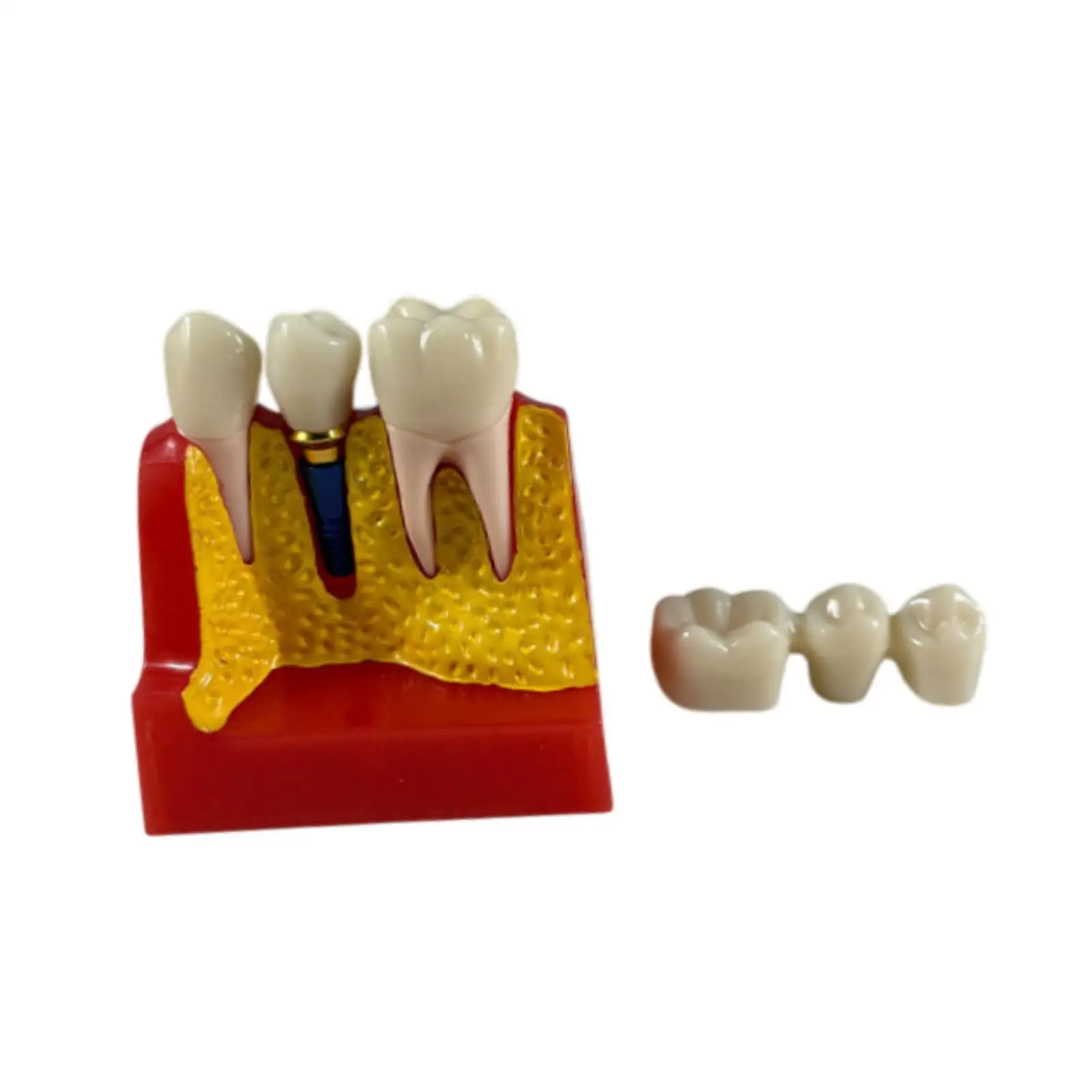 4 Times Tooth Model,Teaching Model,Oral Hygiene Preventive Care,Tooth Teaching Display Model Resin for Kids Students Patients
4 Times Tooth Model,Teaching Model,Oral Hygiene Preventive Care,Tooth Teaching Display Model Resin for Kids Students Patients