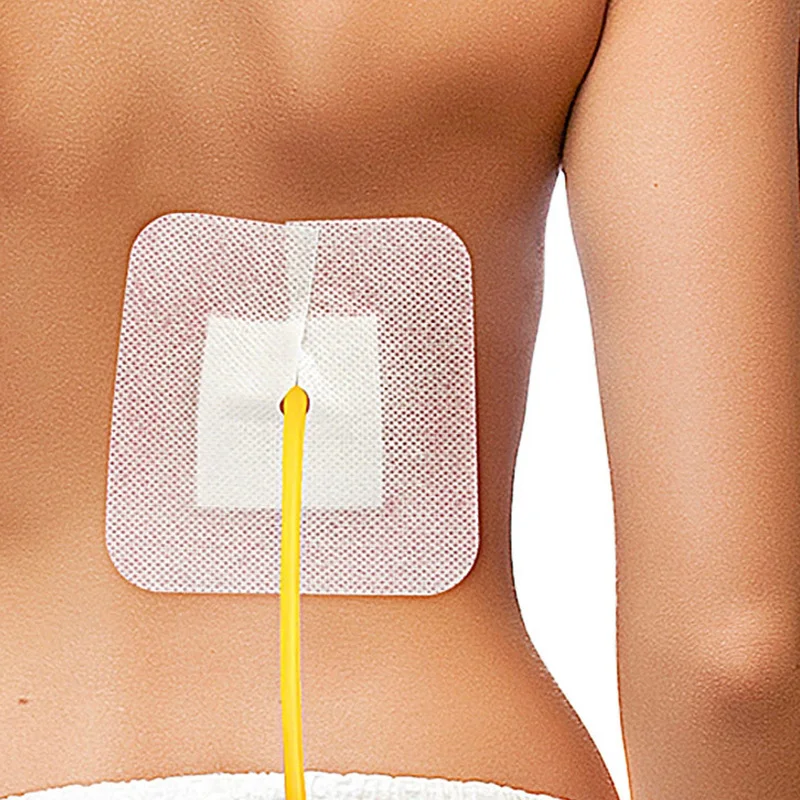 10Pcs Drainage Tube Sterile Applicator Peritoneal Dialysis Catheter Bile Duct Nephrostomy Gastric Tube With Hole Sticker Fixed
10Pcs Drainage Tube Sterile Applicator Peritoneal Dialysis Catheter Bile Duct Nephrostomy Gastric Tube With Hole Sticker Fixed