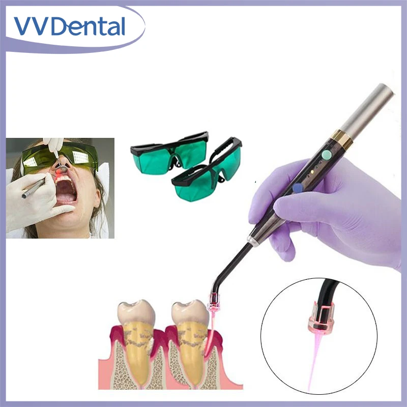 VVDental Wireless Dental Diode Laser System Photo-Activated Heal Laser Pen Oral Soft Tissue Lamp Perio Endo Surgical Light
VVDental Wireless Dental Diode Laser System Photo-Activated Heal Laser Pen Oral Soft Tissue Lamp Perio Endo Surgical Light