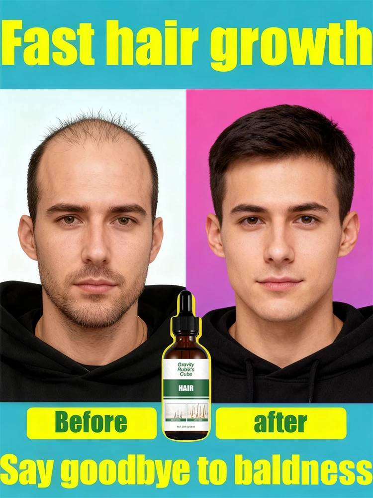 30 days to get a frizzy sea of hair, forehead, hairline and parting are all done
30 days to get a frizzy sea of hair, forehead, hairline and parting are all done