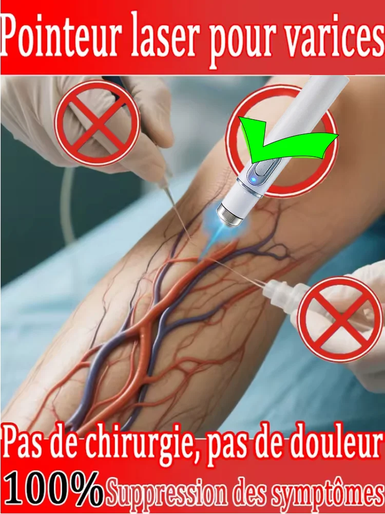 Generation Varicose Vein 3nd Laser Pointer Treatment Laser Eliminates Vasculitis and Phlebitis Relieves Spider Leg Pain Tool
Generation Varicose Vein 3nd Laser Pointer Treatment Laser Eliminates Vasculitis and Phlebitis Relieves Spider Leg Pain Tool