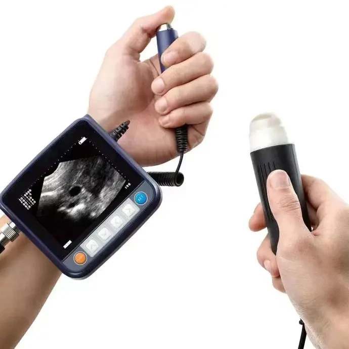 Professional Animal Ultrasound Scanner Wrist V9 Veterinary Scanner
Professional Animal Ultrasound Scanner Wrist V9 Veterinary Scanner