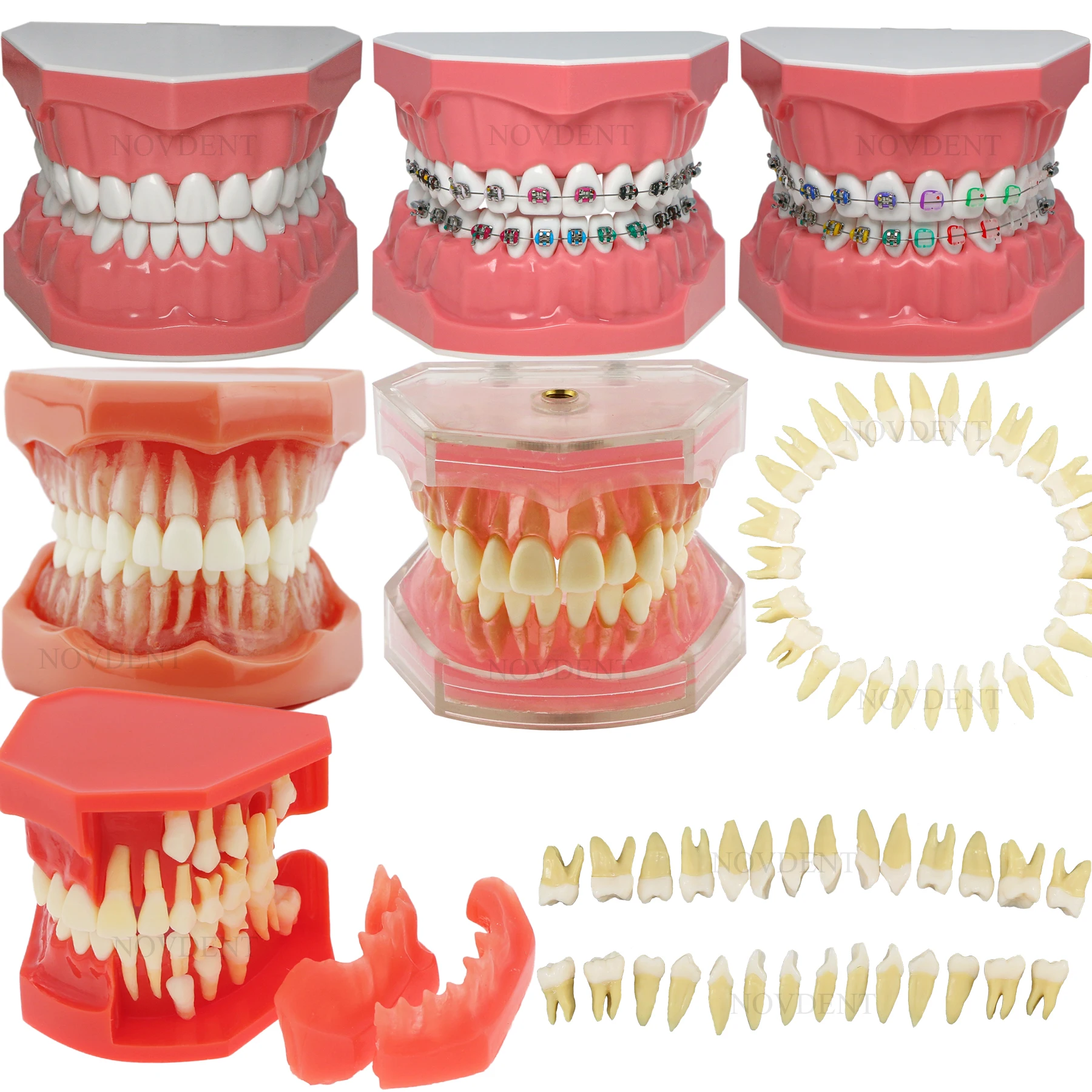 Dental Typodont Model Orthodontic Removable Teeth Implant Models Implant Restoration Practice Demo Study Dentist Material
Dental Typodont Model Orthodontic Removable Teeth Implant Models Implant Restoration Practice Demo Study Dentist Material
