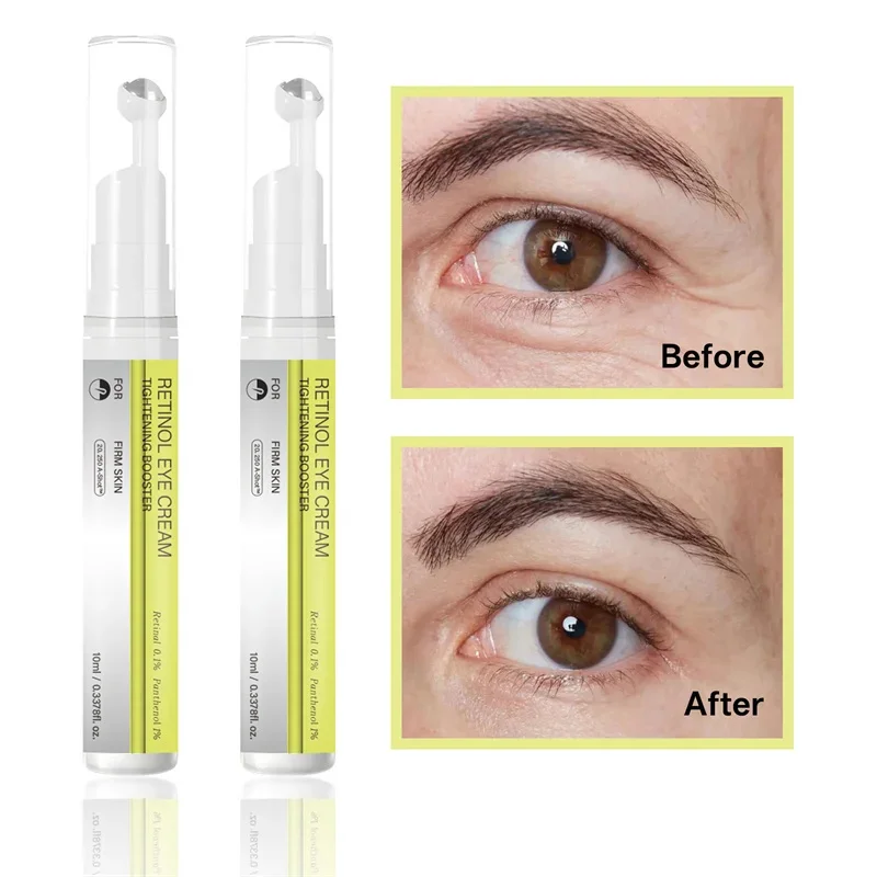 Корейская сыворотка-усилитель Vita A Retinol Shot Tighten Booster и крем для глаз, лифтинг, антивозрастной, сужающий поры, темные круги, ремонтный набор для ухода за кожей
Корейская сыворотка-усилитель Vita A Retinol Shot Tighten Booster и крем для глаз, лифтинг, антивозрастной, сужающий поры, темные круги, ремонтный набор для ухода за кожей