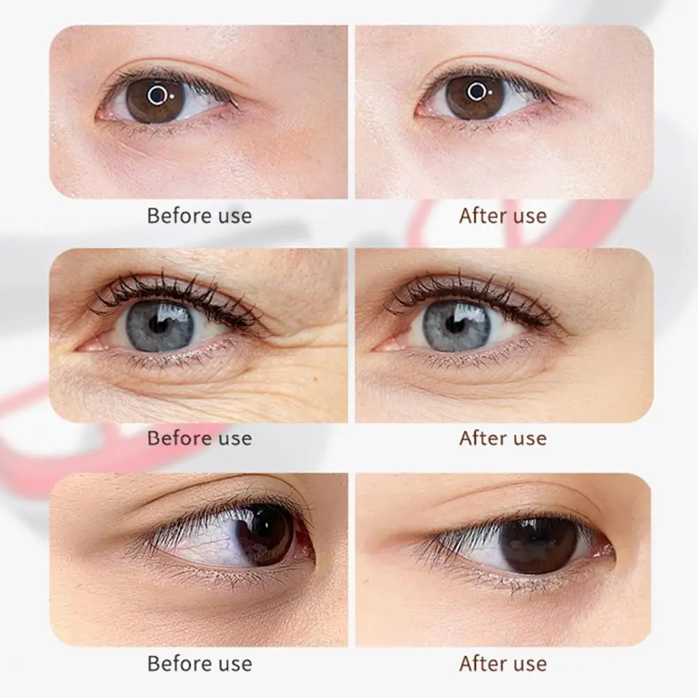 Светотерапия для омоложения кожи Портативные светотерапевтические очки для удаления морщин под глазами Укрепляющие кожу светодиодные очки для эффективности
Светотерапия для омоложения кожи Портативные светотерапевтические очки для удаления морщин под глазами Укрепляющие кожу светодиодные очки для эффективности