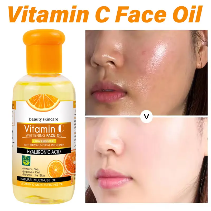 Powerful Whitening Serum With Vitamin C Skin Brighten Essence Removal Dark Spots Moisturizing Skin Beauty Skin Care
Powerful Whitening Serum With Vitamin C Skin Brighten Essence Removal Dark Spots Moisturizing Skin Beauty Skin Care