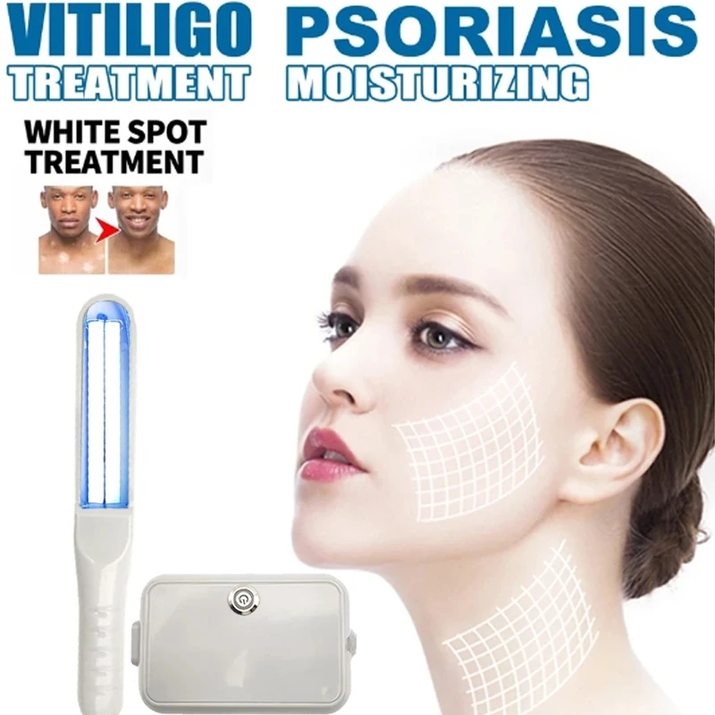 UVB 311nm Phototherapy Vitiligo Excimer Phototherapy Lamp UVB Treatment Of Psoriasis, Eczema, Pityriasis, Rose Spots
UVB 311nm Phototherapy Vitiligo Excimer Phototherapy Lamp UVB Treatment Of Psoriasis, Eczema, Pityriasis, Rose Spots