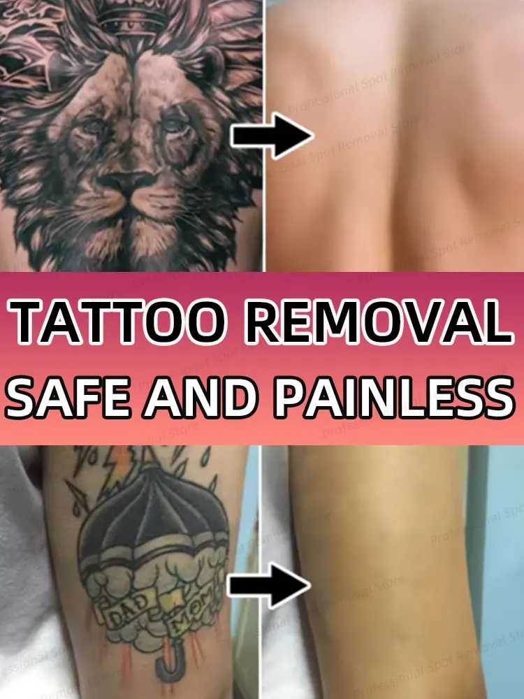 For the removal of colored permanent makeup tattoos, fast tattoo removal cream, text tattoo removal, pattern tattoo removal
For the removal of colored permanent makeup tattoos, fast tattoo removal cream, text tattoo removal, pattern tattoo removal