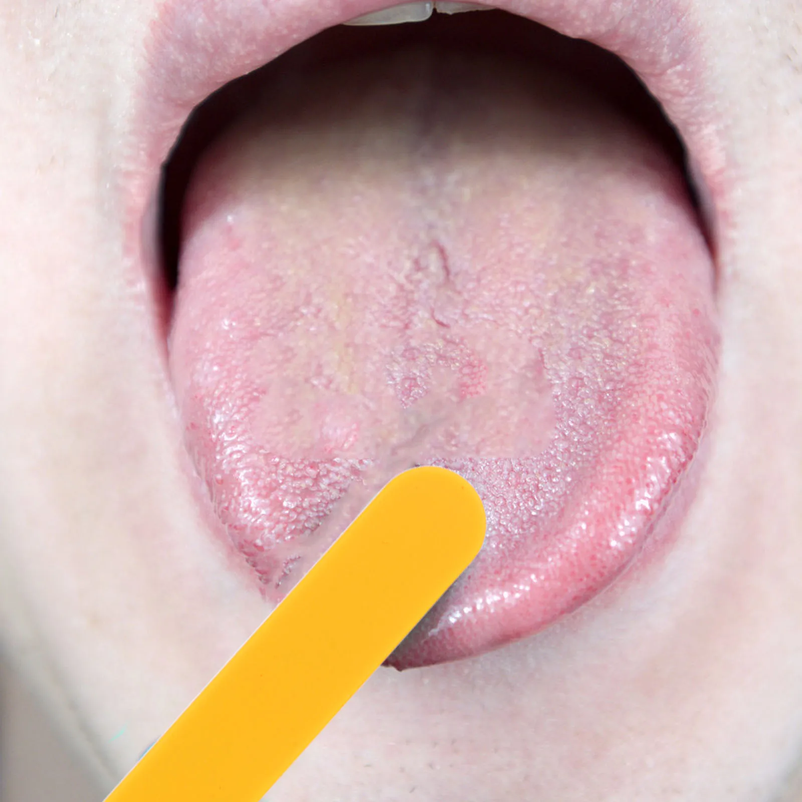 20pcs Plastic Tongue Depressors Oral Examination Training Tools Pediatric Sturdy Durable Reusable Cleanable
20pcs Plastic Tongue Depressors Oral Examination Training Tools Pediatric Sturdy Durable Reusable Cleanable