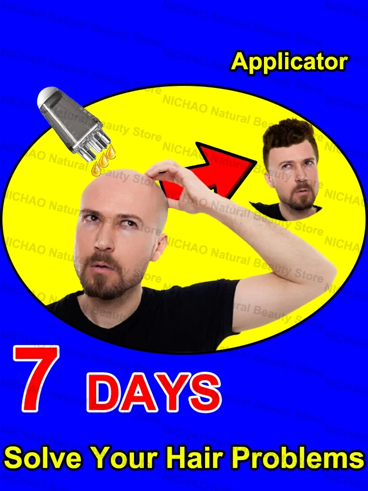 7 Days Fast Hair Growth Essential Loss Regrowth Treatment Strengthens Hair Nourishes Scalp Light Weight Non Greasy
7 Days Fast Hair Growth Essential Loss Regrowth Treatment Strengthens Hair Nourishes Scalp Light Weight Non Greasy