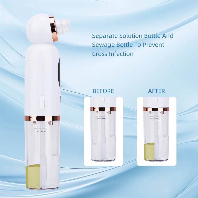 Spot Delivery Facial Cleaning Beauty Machine Peeling Away Dead Skin Professional Facial Vacuum Blackhead Removal Clean
Spot Delivery Facial Cleaning Beauty Machine Peeling Away Dead Skin Professional Facial Vacuum Blackhead Removal Clean