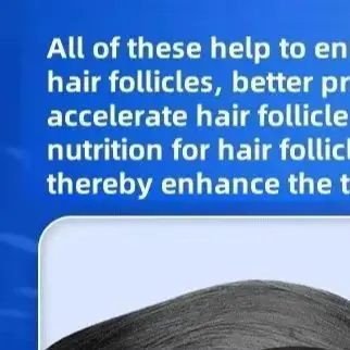 Clinical-Strength 96-Diode LLLT Laser Cap Maximum Scalp Coverage for Enhanced Hair Restoration in Both Men & Women
Clinical-Strength 96-Diode LLLT Laser Cap Maximum Scalp Coverage for Enhanced Hair Restoration in Both Men & Women