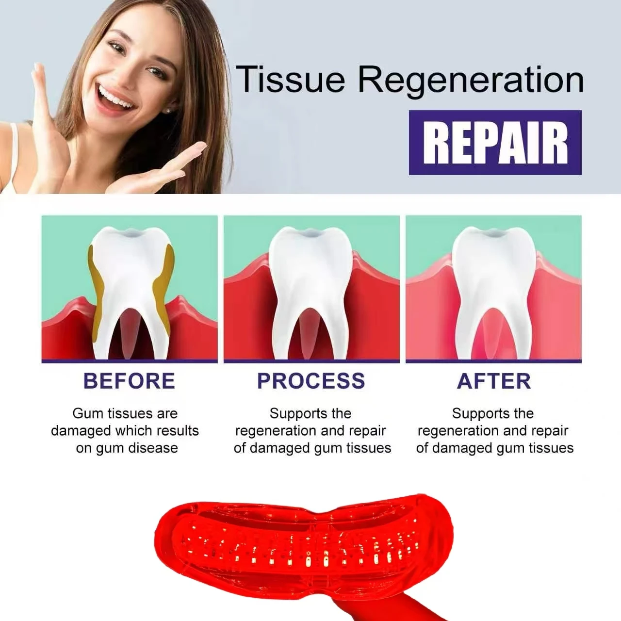 Swollen gums relieve toothache Laser light periodontitis treatment Cure worms Antibacterial mouth laser braces
Swollen gums relieve toothache Laser light periodontitis treatment Cure worms Antibacterial mouth laser braces