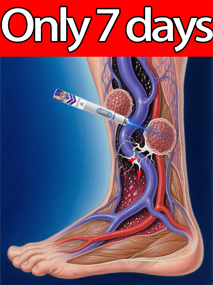 Vᴀʀɪᴄᴏsᴇ ᴠᴇɪɴ ʟᴀsᴇʀ ɪɴsᴛʀᴜᴍᴇɴᴛ
Vᴀʀɪᴄᴏsᴇ ᴠᴇɪɴ ʟᴀsᴇʀ ɪɴsᴛʀᴜᴍᴇɴᴛ