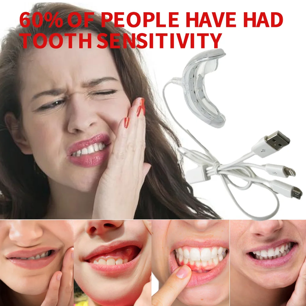 LED Teeth Whitening Portable USB Charging Dental Oral Fresh Tooth Hygiene Care Therapeutic Equipment
LED Teeth Whitening Portable USB Charging Dental Oral Fresh Tooth Hygiene Care Therapeutic Equipment