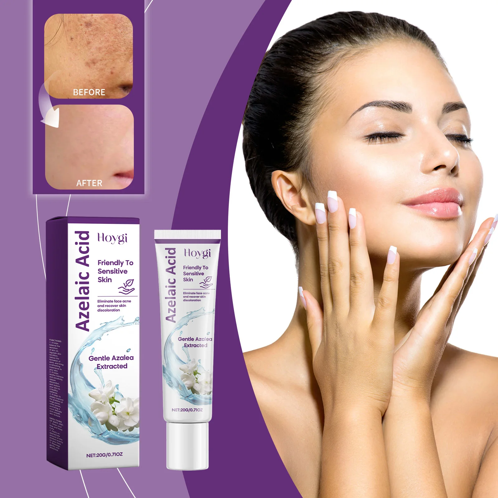 Acne-Clearing Care Cream Improves Skin Moisture And Moisturizes Facial Skin With Delicate And Smooth Pores
Acne-Clearing Care Cream Improves Skin Moisture And Moisturizes Facial Skin With Delicate And Smooth Pores