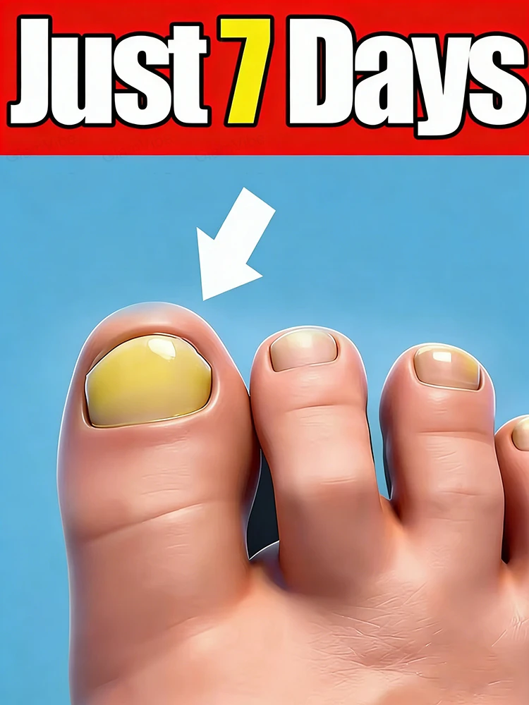 Say goodbye to yellowing and dullness, cultivate transparent and shiny nails!
Say goodbye to yellowing and dullness, cultivate transparent and shiny nails!