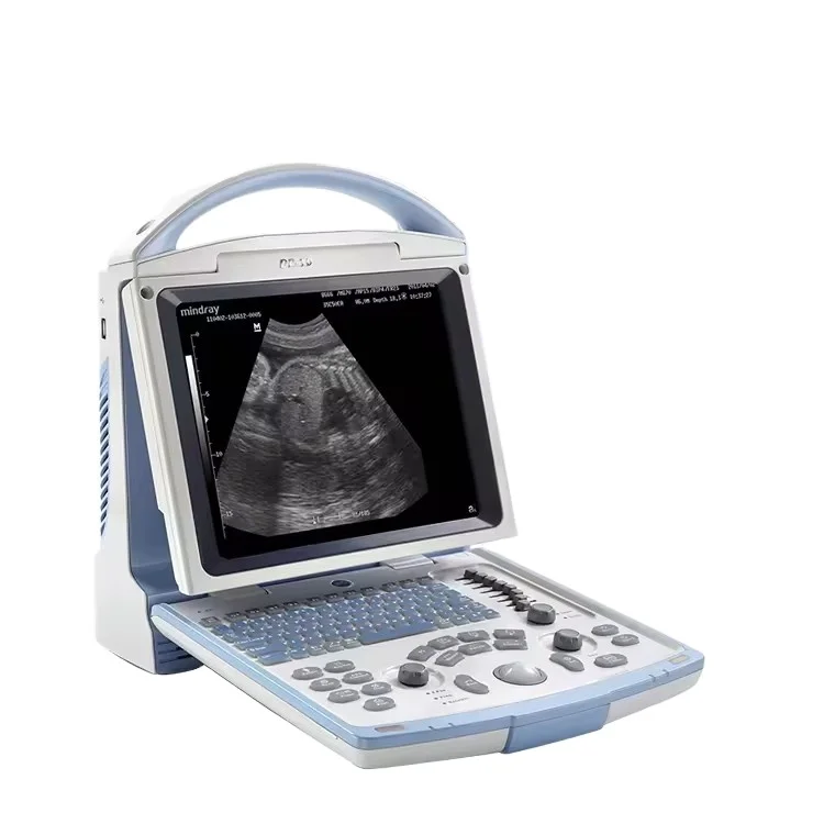 Mindray Portable Medical Ultrasonido Sonografo Portatil Ecografo Mindray Dp 10 Ultrasound Machine
Mindray Portable Medical Ultrasonido Sonografo Portatil Ecografo Mindray Dp 10 Ultrasound Machine