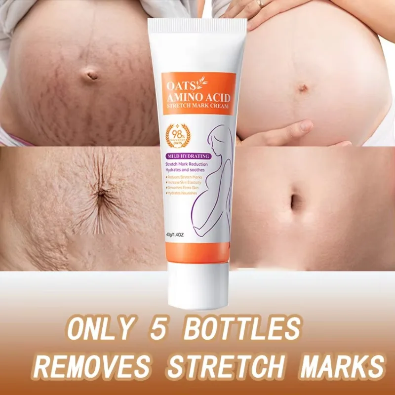 Maternity Stretch Mark Permanent Removal cream Brighten Anti-Winkle Smooth Repair Firming Restore Skin Elasticity Body Skin Care
Maternity Stretch Mark Permanent Removal cream Brighten Anti-Winkle Smooth Repair Firming Restore Skin Elasticity Body Skin Care