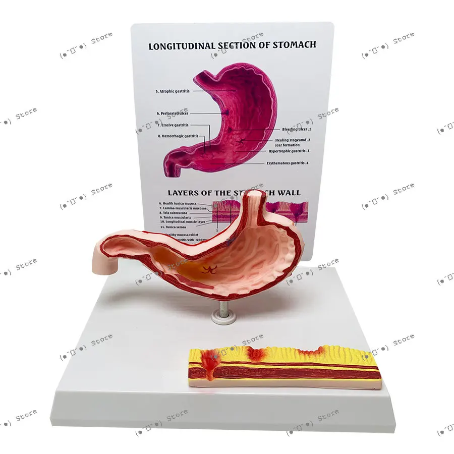 Stomach Anatomy Model Stomach Abdominal Pathological Anatomy Model Structure Human Teaching Aids Human Anatomy Model
Stomach Anatomy Model Stomach Abdominal Pathological Anatomy Model Structure Human Teaching Aids Human Anatomy Model