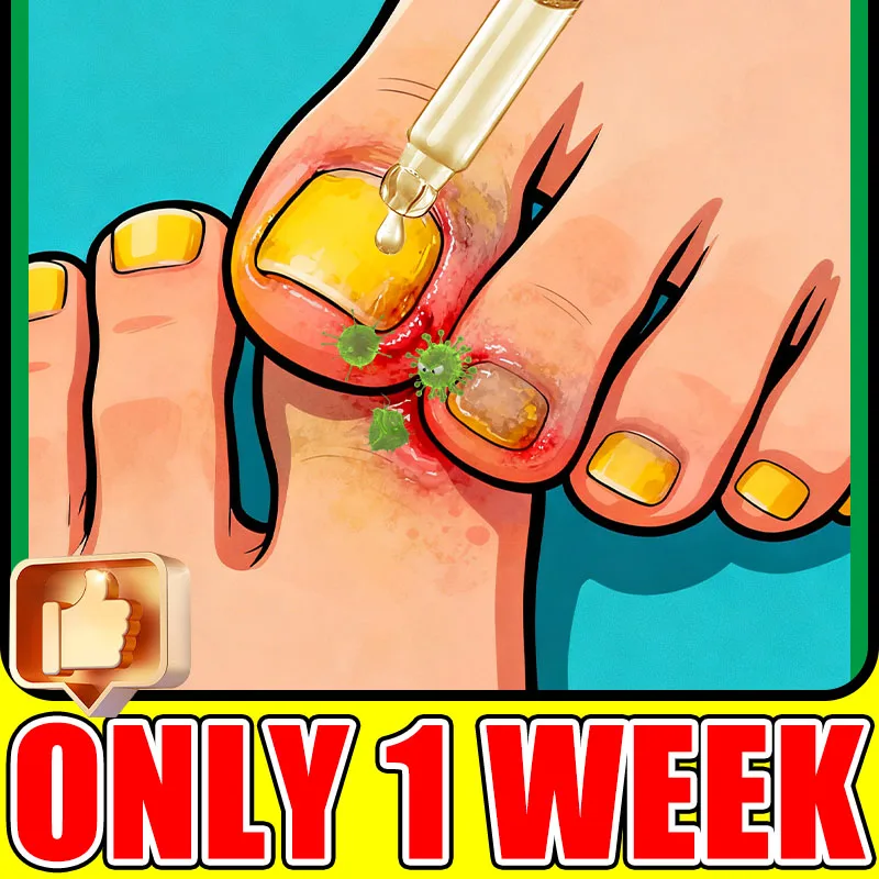 Choosing a Good Nail Care Kilometer to Give You Healthy and Beautiful Feet
Choosing a Good Nail Care Kilometer to Give You Healthy and Beautiful Feet