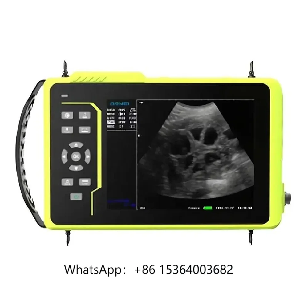 VS-V597 Portable Vet Ultrasound Scanner for Animal Waterproof Handheld Ultrasonic Diagnostic Instrument
VS-V597 Portable Vet Ultrasound Scanner for Animal Waterproof Handheld Ultrasonic Diagnostic Instrument