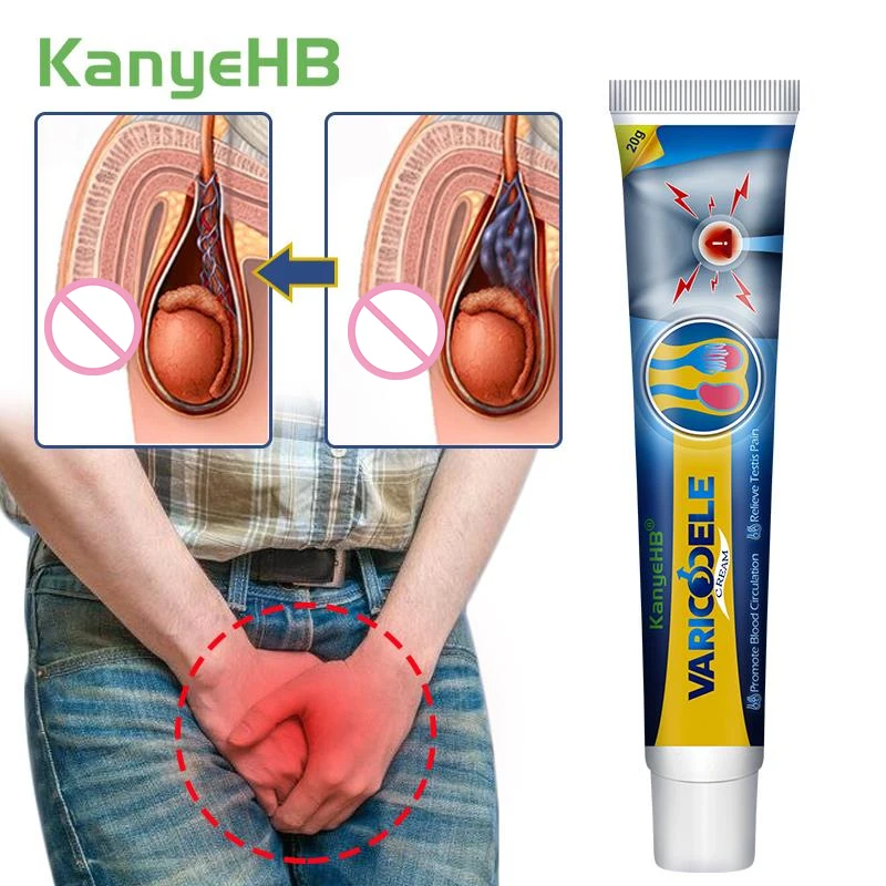 1Pcs Genital Scrotum Varicocele Cream Varicose Veins Treatment Angiitis Phlebitis Leg Veins Pain Removal Medical Ointment G039
1Pcs Genital Scrotum Varicocele Cream Varicose Veins Treatment Angiitis Phlebitis Leg Veins Pain Removal Medical Ointment G039