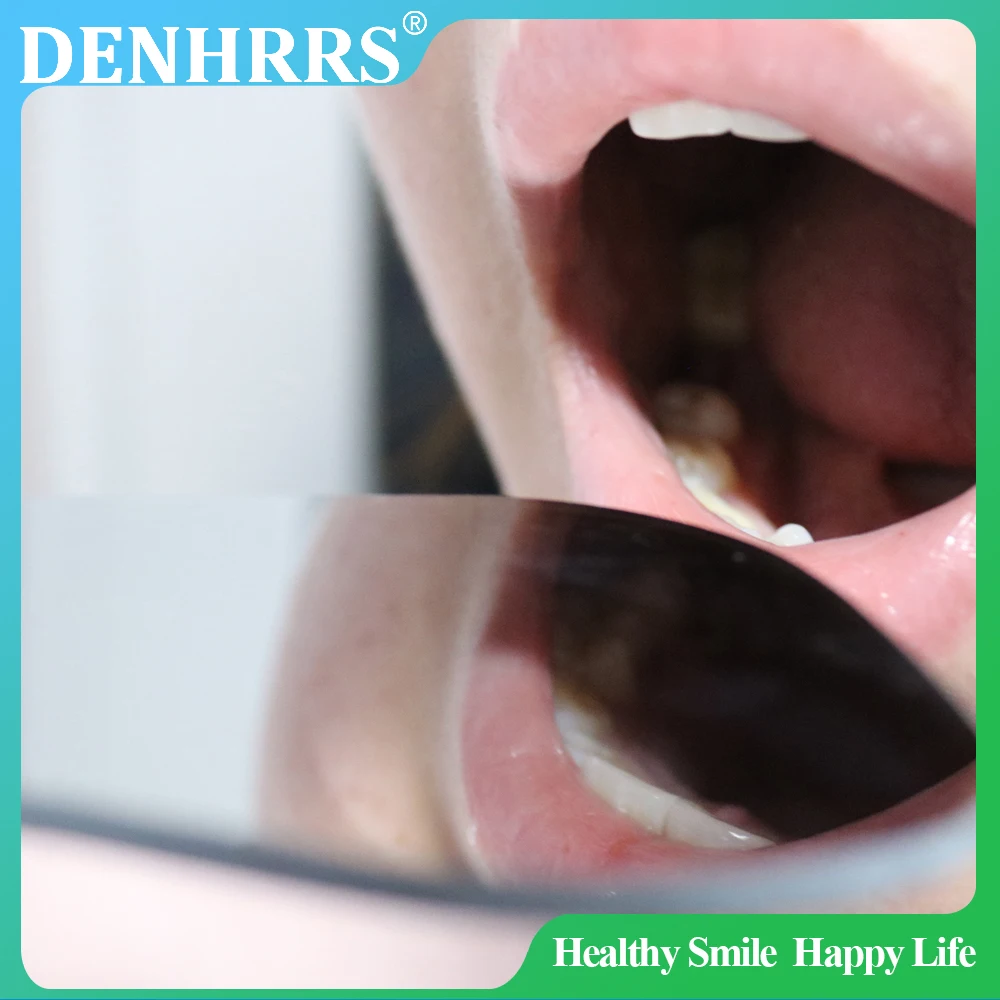 1 шт., стоматологическое ортодонтическое стеклянное зеркало, зеркала для фотосъемки, отражатель, инструмент для стоматологии полости рта
1 шт., стоматологическое ортодонтическое стеклянное зеркало, зеркала для фотосъемки, отражатель, инструмент для стоматологии полости рта