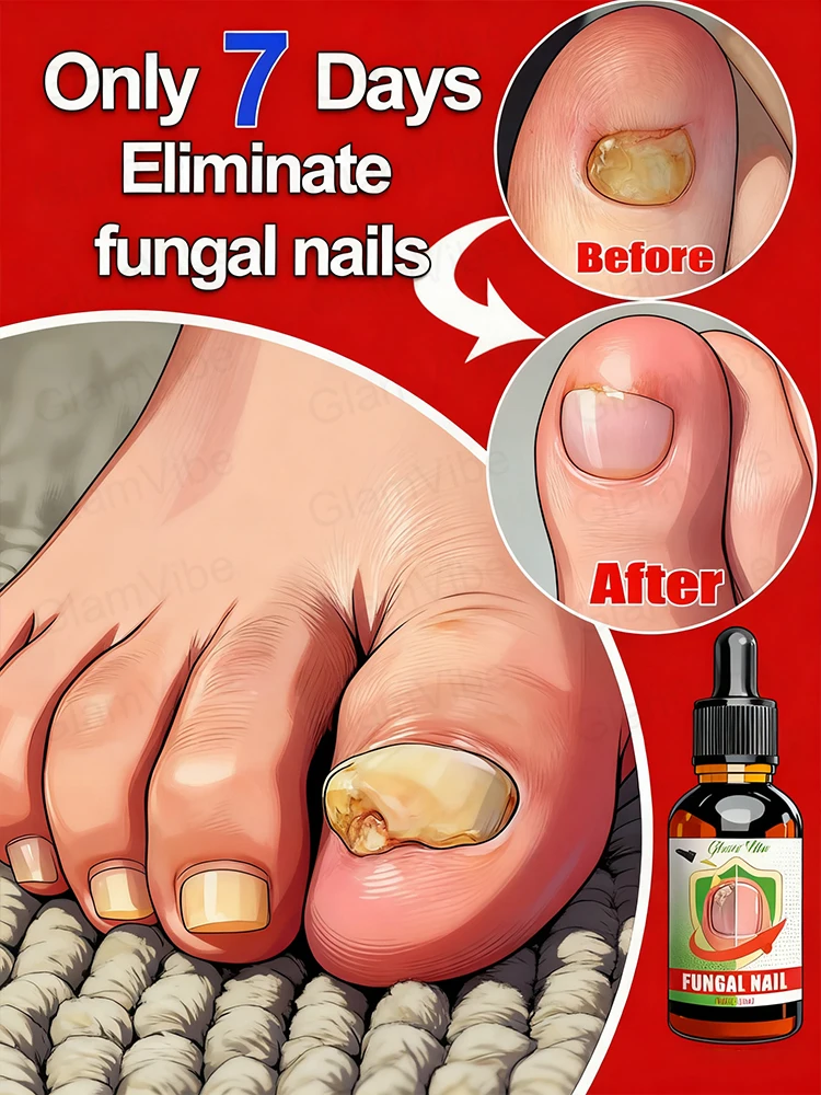 Cᴜsᴛᴏᴍɪᴢᴇᴅ sᴏʟᴜᴛɪᴏɴs ᴛᴏ ʀᴇsᴛᴏʀᴇ ʜᴇᴀʟᴛʜʏ ᴀɴᴅ ʜᴇᴀʟᴛʜʏ ɴᴀɪʟ ᴛᴇxᴛᴜʀᴇ
Cᴜsᴛᴏᴍɪᴢᴇᴅ sᴏʟᴜᴛɪᴏɴs ᴛᴏ ʀᴇsᴛᴏʀᴇ ʜᴇᴀʟᴛʜʏ ᴀɴᴅ ʜᴇᴀʟᴛʜʏ ɴᴀɪʟ ᴛᴇxᴛᴜʀᴇ