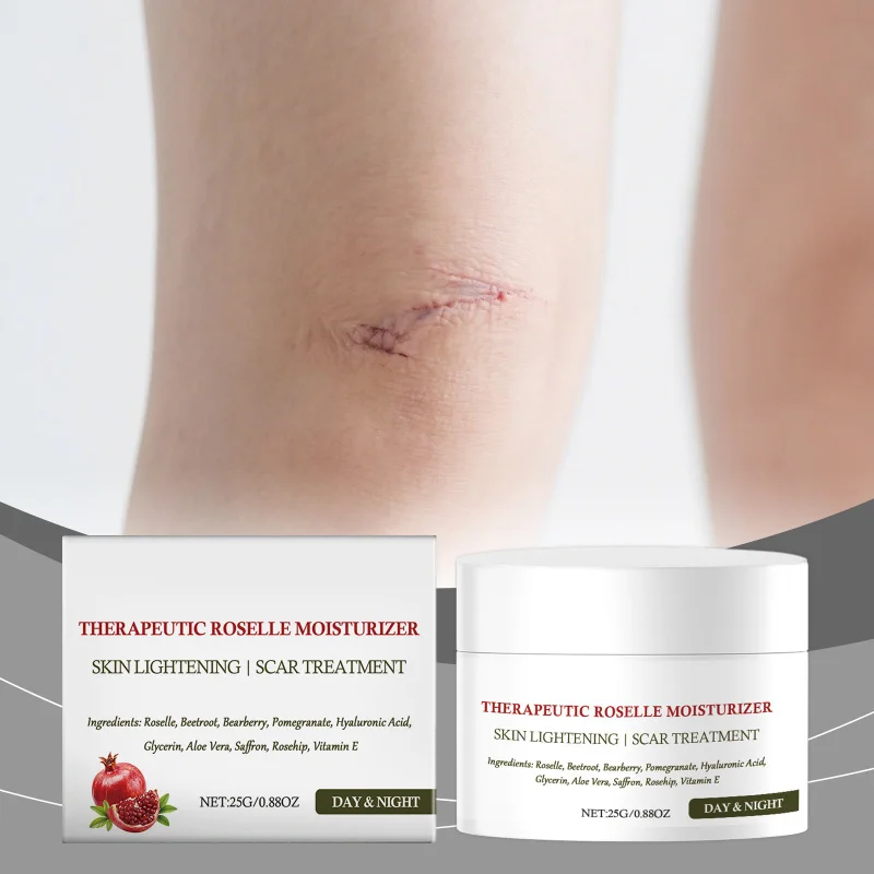 Daily Normal Acne Fragile Skin Nourish Hydrate Moisturize Soothe Breakouts and Maintain Health of Weakened Acne Skin
Daily Normal Acne Fragile Skin Nourish Hydrate Moisturize Soothe Breakouts and Maintain Health of Weakened Acne Skin