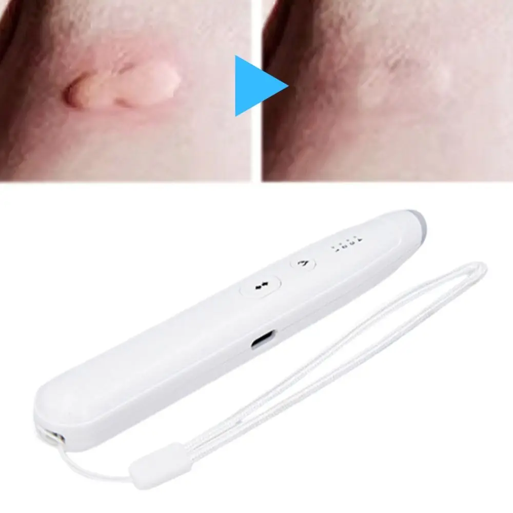 Rechargeable Mosquito Insect Bite Relieve Itching Pen Portable Chemical-Free Natural Bite Itch Relief Pen Anti-Itch Pen
Rechargeable Mosquito Insect Bite Relieve Itching Pen Portable Chemical-Free Natural Bite Itch Relief Pen Anti-Itch Pen