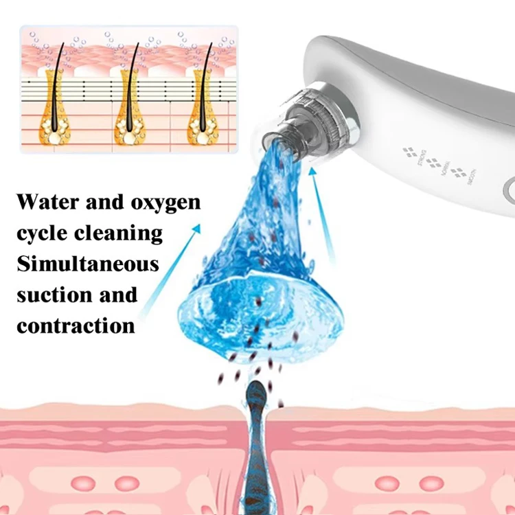 Вакуумное средство для удаления черных точек и прыщей на лице, очищает кожу, грязь, пылесос, глубоко очищает поры, средство для удаления грязи от черных точек
Вакуумное средство для удаления черных точек и прыщей на лице, очищает кожу, грязь, пылесос, глубоко очищает поры, средство для удаления грязи от черных точек