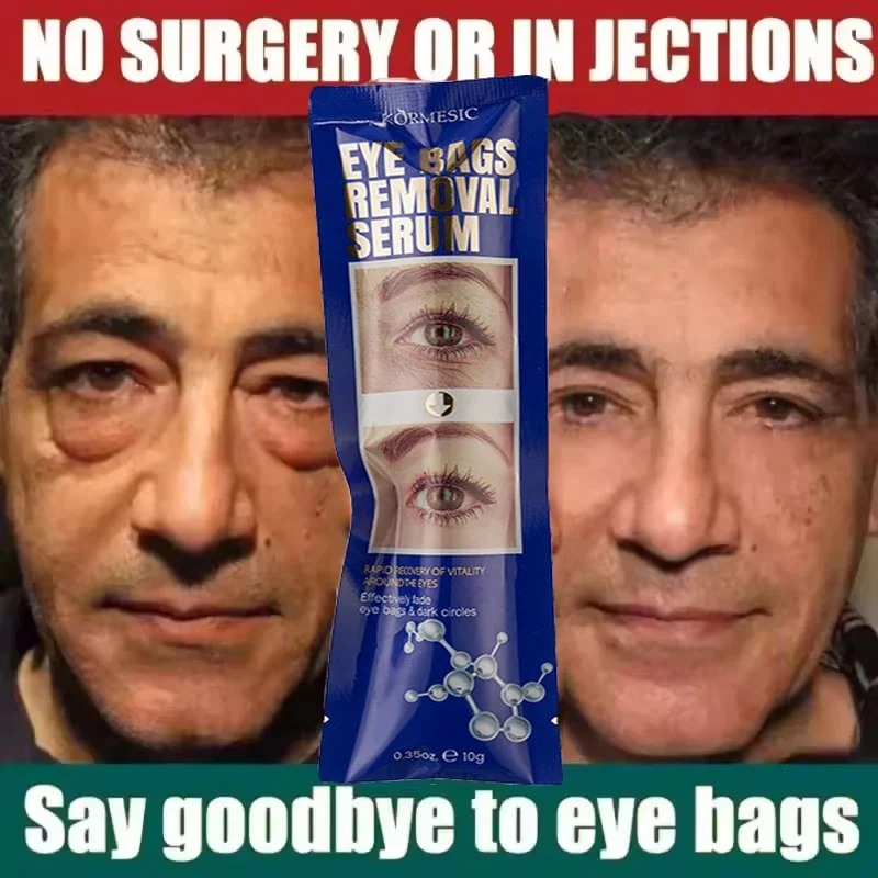 Instant Eye Bag Removal Cream Retinol Anti-Wrinkle Firming Fade Fine Lines Anti Dark Circle Puffiness Brighten Eye Care Product
Instant Eye Bag Removal Cream Retinol Anti-Wrinkle Firming Fade Fine Lines Anti Dark Circle Puffiness Brighten Eye Care Product