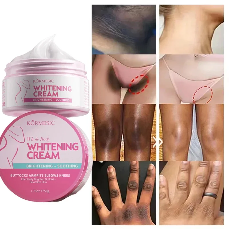 Body Whitening Bleach Cream Brighten Underarm Elbow Knees Joint Removal Intimate Parts Dark Spots Melanin Snow Bleach Cream
Body Whitening Bleach Cream Brighten Underarm Elbow Knees Joint Removal Intimate Parts Dark Spots Melanin Snow Bleach Cream